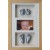 Classic 16x10'' Triple Frame Baby Casting Kit