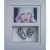 OPT18 - 10x8'' Double Photo Frame - 1 Hand & 1 Foot - About 135