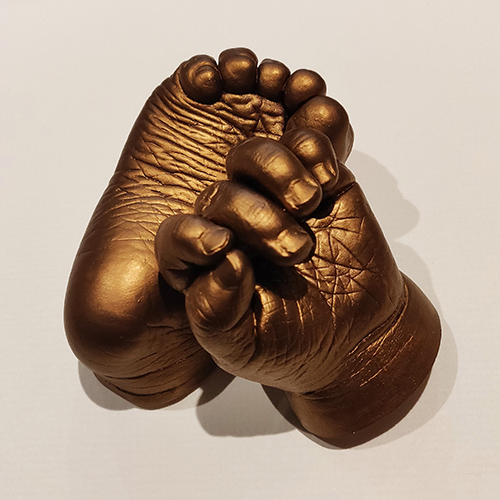 Gold wrinkly hand and foot of a 1 year old.